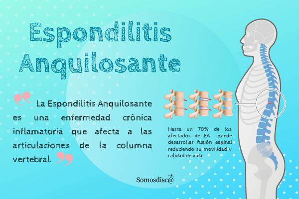Me dan incapacidad por ESPLANDILOARTROPATÍA LUMBAR