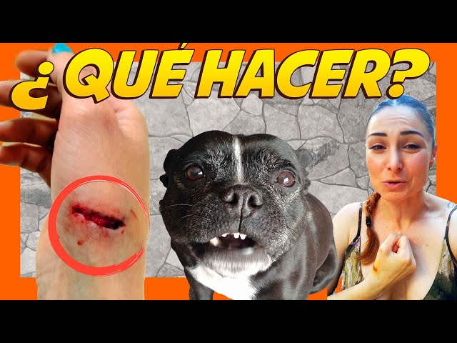 Qué hacer si te muerde un perro Guía y recomendaciones